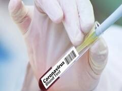 No vaccine till 15 August, says Health Ministry