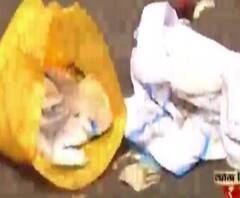 ময়লার গাড়ি নিয়ে যাওয়ার সময় পড়ে গেল পিপিই ভর্তি ব্যাগ! ভয়ে কাঁটা আর জি কর হাসপাতাল সংলগ্ন এলাকার বাসিন্দারা