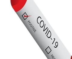 ১২৩ নম্বর ওয়ার্ডের বিদায়ী কাউন্সিলর সুদীপ পোল্যে করোনায় আক্রান্ত 