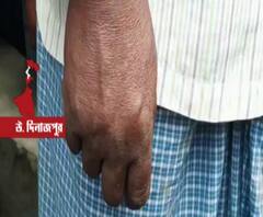 মৃত্যুর পর ঝোলানো হয়নি, গলার ফাঁসেই মৃত্যু হেমতাবাদের বিধায়কের, মত ফরেন্সিক বিশেষজ্ঞদের