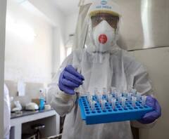 COVID-19 Vaccin | गुड न्यूज! ऑक्सफर्ड विद्यापीठात कोरोना लसीची मानवी चाचणी यशस्वी