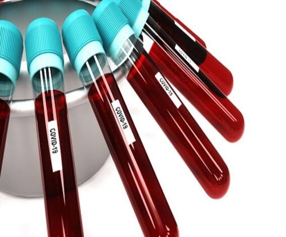 Pune Lockdown Failed? पुण्यात लॉकडाऊन फसला? पुणेकरांचा प्रशासनाला सवाल | स्पेशल रिपोर्ट