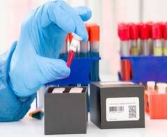 What is Sero Survey? सेरो सर्वेक्षण काय आहे? सेरो सर्वेक्षणाला घाबरू नका,पाहा सेरोचा स्पेशल रिपोर्ट