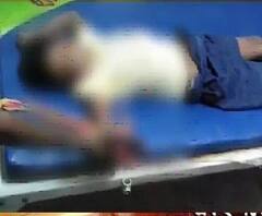 খেলার সময় মোবাইলের ব্যাটারি ফেটে ডানহাতের গোটা তালু উড়ে গেল ষষ্ঠ শ্রেণির পড়ুয়ার!