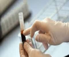 উত্তরবঙ্গে প্রথম প্লাজমা দান করলেন করোনাজয়ী স্বাস্থ্য আধিকারিক