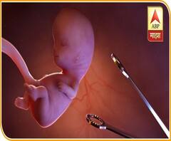 Female Feticide | जेलची हवा खाल्ल्यानंतरही सुदाम मुंडेचा काळा धंदा सुरूच, स्त्री भ्रूण हत्येचा पर्दाफाश