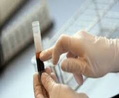 একদিনে ৬২ জন করোনা রোগীর মৃত্যু, তবে রাজ্যে বাড়ল সুস্থতার হার