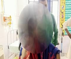 Gonda में Acid Attack से सनसनी, रोशन दान से तीन बहनों पर फेंका तेजाब| ABP Ganga