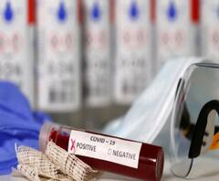 Uttarakhand में कोरोना के मामलों में गिरावट, मरीजों की मौत के मामले भी हुए कम | ABPGanga 