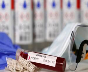 Uttarakhand में कोरोना के मामलों में गिरावट, मरीजों की मौत के मामले भी हुए कम | ABPGanga 