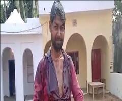 पुलिस से परेशान होकर शख्स ने की खुदकुशी की कोशिश, केस दर्ज। Agra News