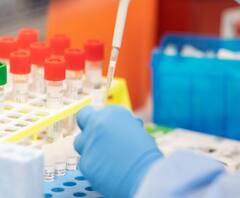 भारत में कोरोना को लेकर बड़ी खबर, अब तक हुए 10 करोड़ टेस्ट। Coronavirus