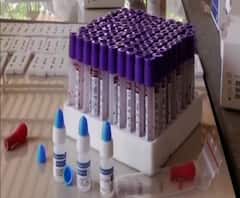 সঠিক দিকে এগোচ্ছে ভ্যাকসিন ট্রায়াল? ভারত বায়োটেকের কাছে তথ্য চাইল এডিএসসিও