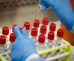 आज से UP में कोरोना सैंपलिंग का दूसरा चरण, बाजारों में भी होगा सैंपल लेने का काम