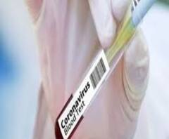 করোনা: দেশে বাড়ল দৈনিক মৃত্যু, কমল সংক্রমণ ও দৈনিক সুস্থতার সংখ্যাও 