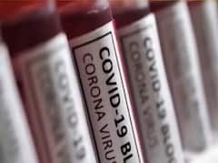 3 भारतीय कंपनियां बना रहीं Corona Vaccine, जानिए हर वैक्सीन का ताजा अपडेट