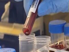 कोरोना की 'मौत वाली वैक्सीन' से बच के! इंटरपोल ने दी चेतावनी!