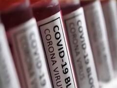 Travelers from UK to India to be tested | Audio Bulletin