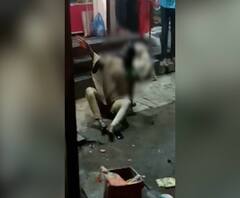 बेळगावच्या रायबागमध्ये फळविक्री करणाऱ्या तरुणीवर अज्ञाताचा अॅसिड हल्ला,अॅसिड हल्ल्यानंतर तरुणी गंभीर