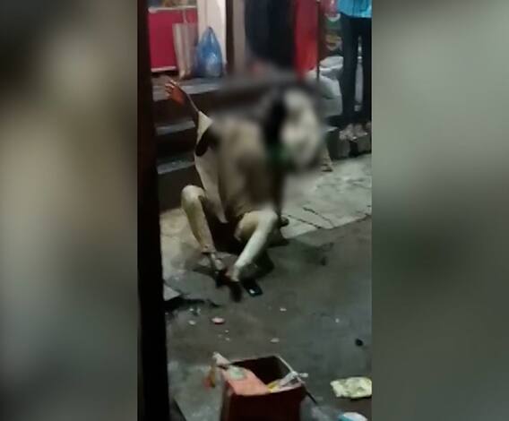 बेळगावच्या रायबागमध्ये फळविक्री करणाऱ्या तरुणीवर अज्ञाताचा अॅसिड हल्ला,अॅसिड हल्ल्यानंतर तरुणी गंभीर