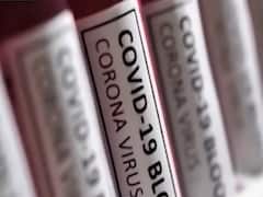 Foreign diplomats to visit Covid vaccine centers in India tomorrow | Master Stroke 