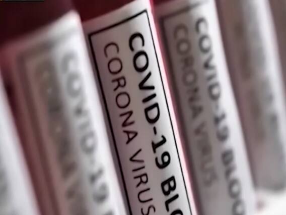 Foreign diplomats to visit Covid vaccine centers in India tomorrow | Master Stroke 