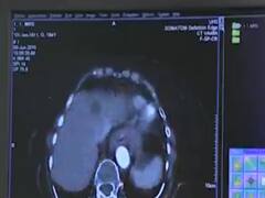 આ ટેસ્ટને કોરોના ટેસ્ટ માનતા લોકો થઇ જાય સાવધાન, જુઓ વીડિયો