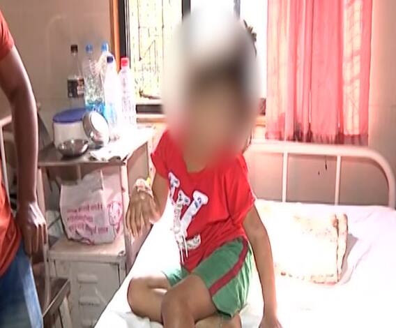 धक्कादायक... अंगावर चटके, मारहाण करत पित्याकडून चिमुकल्यांचा छळ