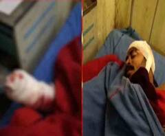 Nadia: চাকদহে বিজেপির বুথ সভাপতির হাত কেটে নেওয়ার অভিযোগ, কাঠগড়ায় তৃণমূল