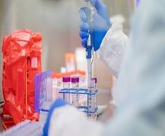 World Corona Update: বিশ্বে করোনায় কমল দৈনিক মৃত্যু-সুস্থতা, বাড়ল সংক্রমণ 