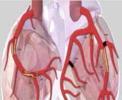 Sourav Ganguly Health Update: ট্রিপল ভেসেল ডিজিজে আক্রান্ত সৌরভ, ঠিক কী এই রোগ? বিশ্লেষণে চিকিৎসক সৌমিত্র রায়