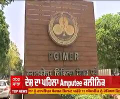 ਚੰਡੀਗੜ PGI ਖੁੱਲਿਆ ਦੇਸ਼ ਦਾ ਪਹਿਲਾ Amputee ਕਲੀਨਿਕ