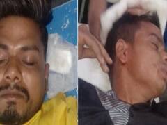 Surat ના પાંડેસરામાં મોડી રાત્રે બે વ્યક્તિઓ પર ફાયરિંગ, જુઓ વીડિયો