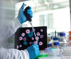 Avian H5N8 Flu in Humans | भीती खरी ठरली; बर्ड फ्लूची माणसांनाही लागण