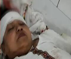 Pilibhit में जिला पंचायत सदस्य महिला उम्मीदवार को गोली मारी, गंभीर हालत में अस्पताल में भर्ती