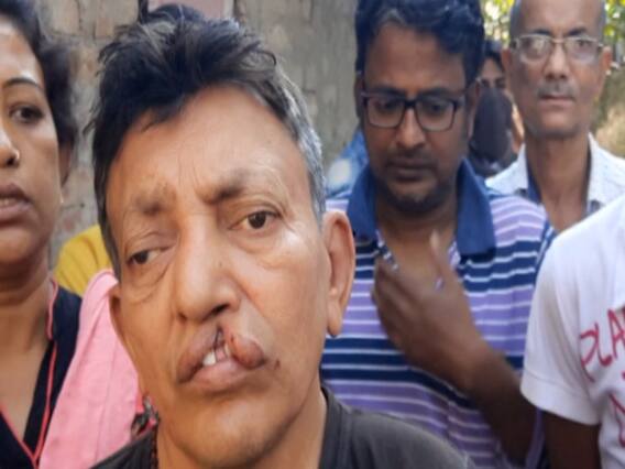 West Bengal : होने वाले हैं चुनाव, पर कब थमेगी ये राजनीतिक हिंसा?